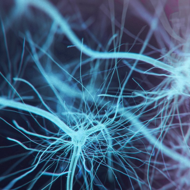 Artist depiction of a network of nerves